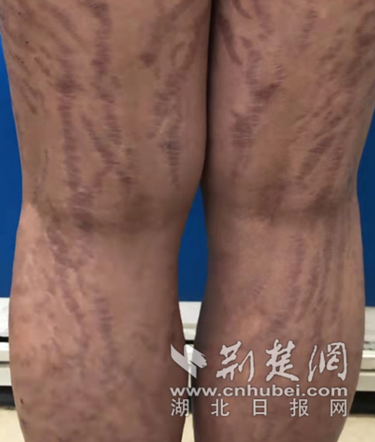 微信截图_20211203111328_副本.png.png
