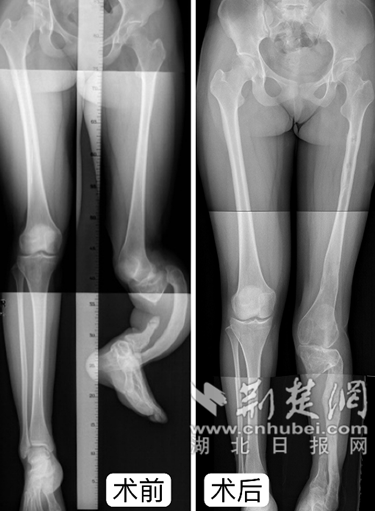 微信截图_20220315101131_副本.png.png