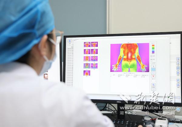 医生在为患者进行红外热成像检测.JPG