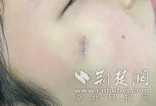 ScreenShot_2026-03-05_204842_452_副本.png.png